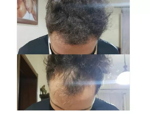 KIT: Fibras capilares de queratina + Fijador + Aplicador Toppik