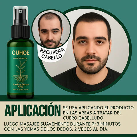 Spray anti-caída del pelo OUHE™