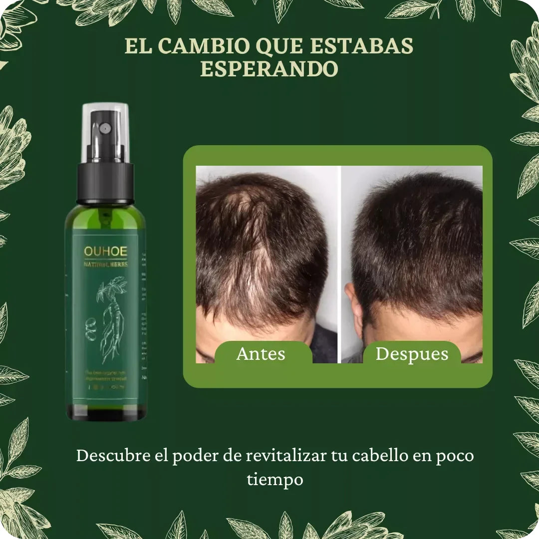 Spray anti-caída del pelo OUHE™